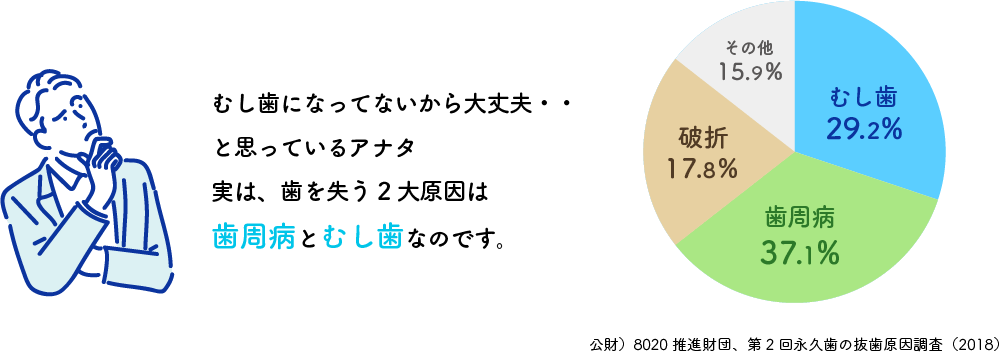 虫歯になっていないから大丈夫・・と思ってるアナタ。実は、歯を失う2大原因は歯周病と虫歯なのです。